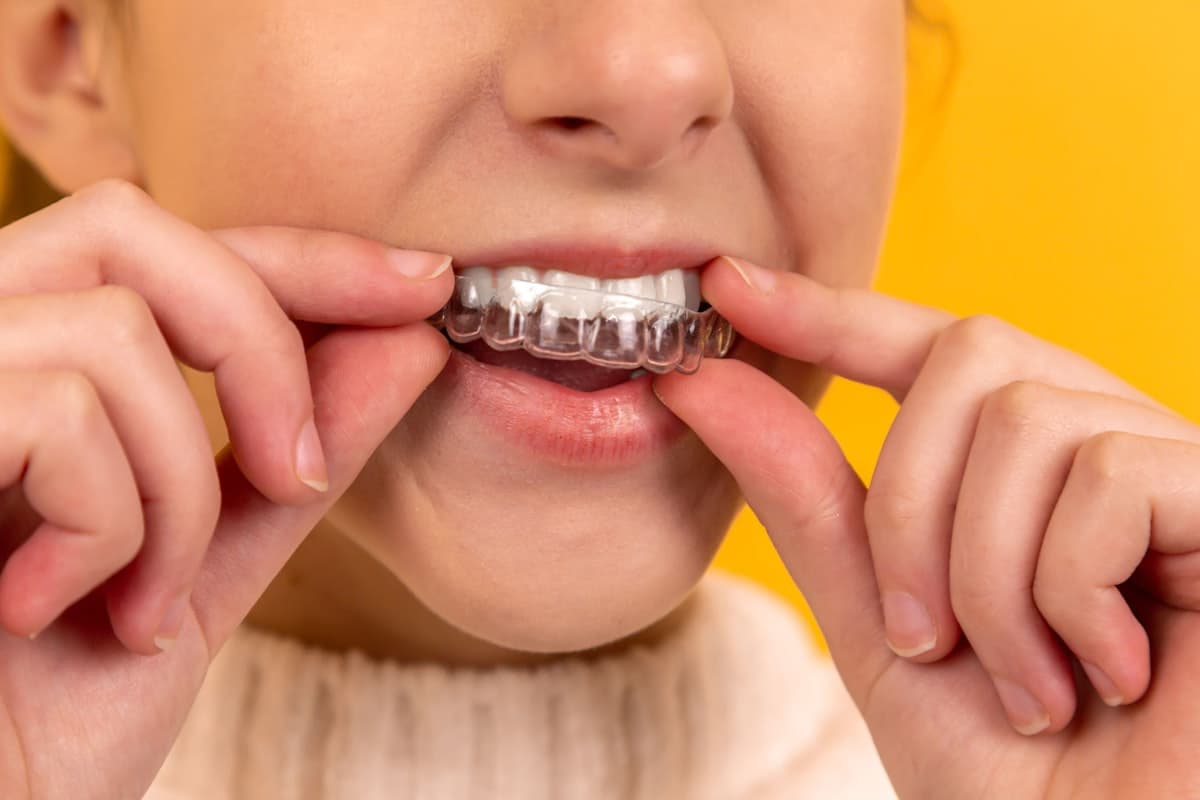 Paciente con brackets durante un tratamiento de ortodoncia en Ingeniero Maschwitz y Escobar