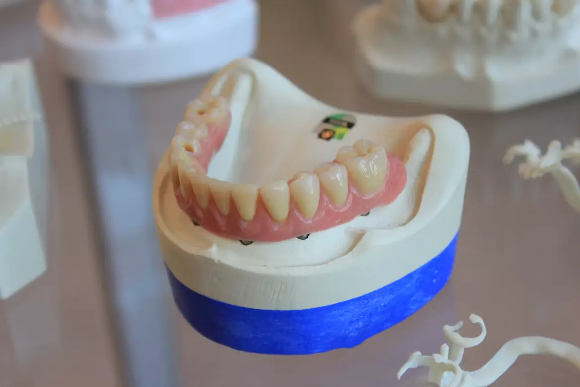 Prótesis dental confeccionada a medida en consultorio de Ingeniero Maschwitz y Escobar